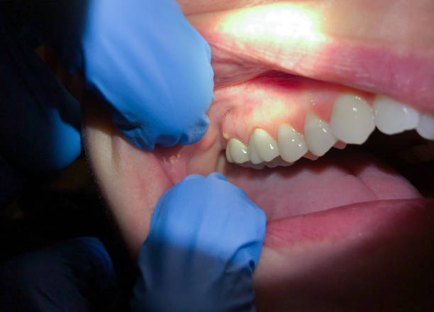 Best Broken or Cracked Tooth Emergency Dentist in Red Oak, TX